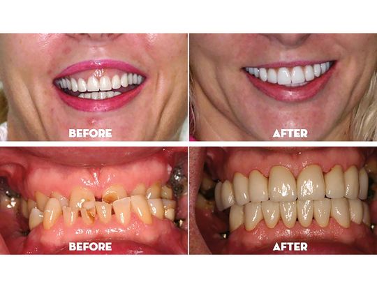 Co dziedziczymy po przodkach?  Wpływ genów na zdrowie jamy ustnej