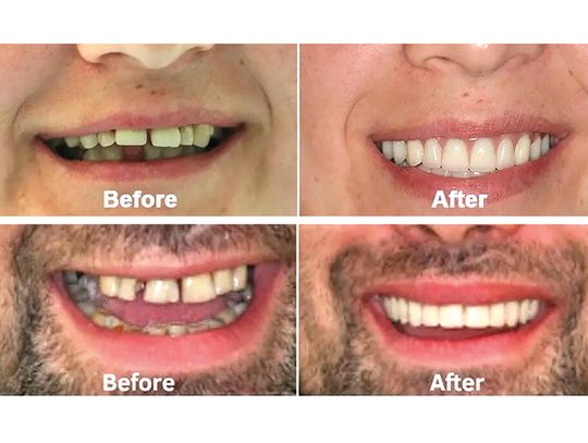 Dlaczego tak wielu młodych ludzi traci zęby? Dlaczego tak wielu młodych ludzi traci zęby?