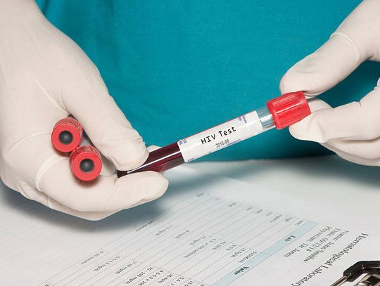 FDA zatwierdziło pierwszy na świecie zastrzyk przeciw HIV