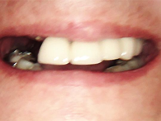 Gdy świąteczna radość spotyka niezręczny moment: prawda o nieświeżym oddechu Gdy świąteczna radość spotyka niezręczny moment: prawda o nieświeżym oddechu