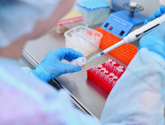 Nowy lek przeciwko HIV trafi do 12 krajów Afryki z pominięciem najbardziej zagrożonej RPA