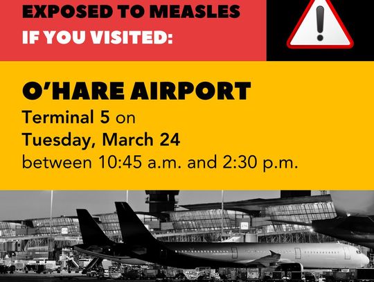 Ostrzeżenie przed odrą: chora osoba przebywała na O’Hare, w Niles i Mount Prospect