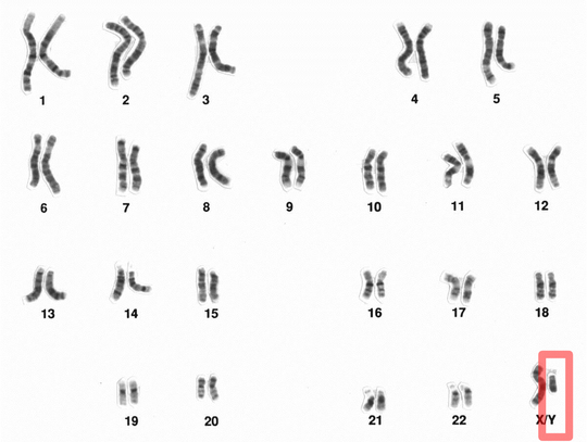 Poznano sekwencję męskiego chromosomu