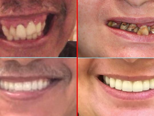 Sezon świąteczny i zdrowie jamy ustnej Sezon świąteczny i zdrowie jamy ustnej