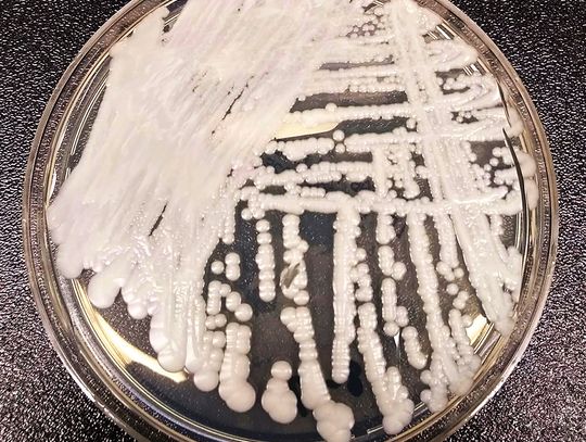 Śmiercionośny grzyb C. auris&nbsp; rozprzestrzenia się w zastraszającym tempie w placówkach służby zdrowia w USA