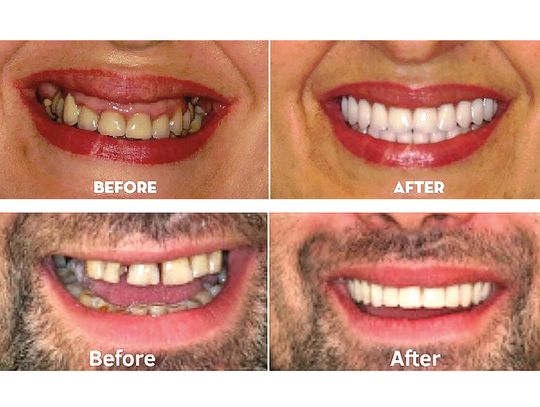 Szukasz lepszej pracy, chcesz zrobić dobre pierwsze wrażenie – zacznij od wizyty u dentysty