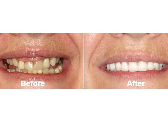 Ukryte infekcje w jamie ustnej i wpływ na zdrowie Ukryte infekcje w jamie ustnej i wpływ na zdrowie