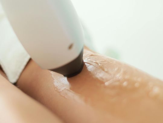 Usuwanie owłosienia w Poznaniu - przegląd metod i zalet depilacji laserowej