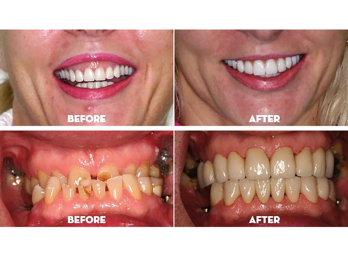 Co dziedziczymy po przodkach?  Wpływ genów na zdrowie jamy ustnej