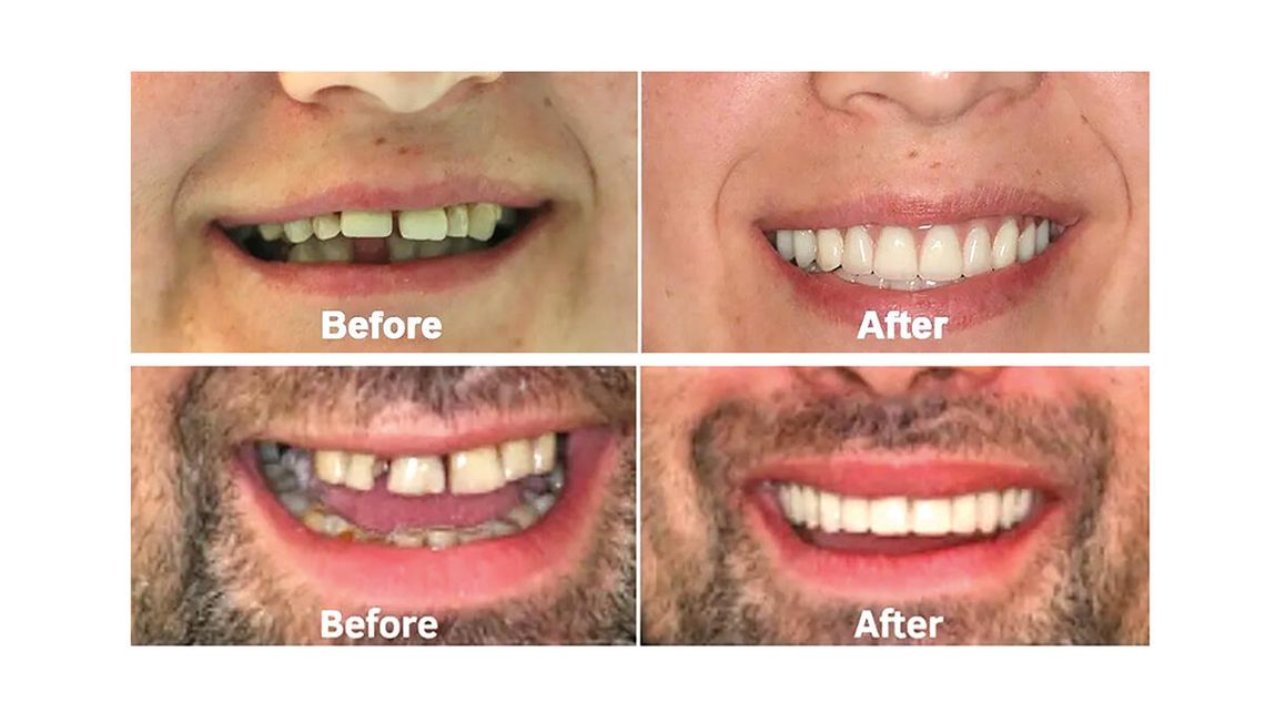 Dlaczego tak wielu młodych ludzi traci zęby?