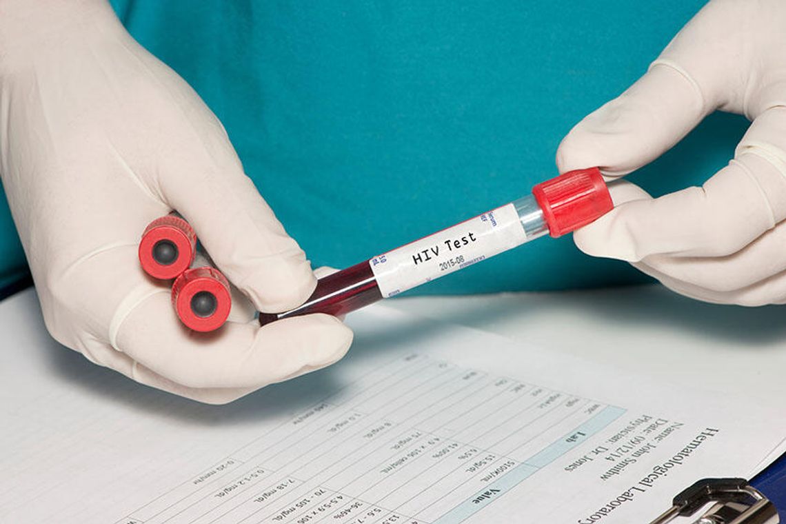 FDA zatwierdziło pierwszy na świecie zastrzyk przeciw HIV