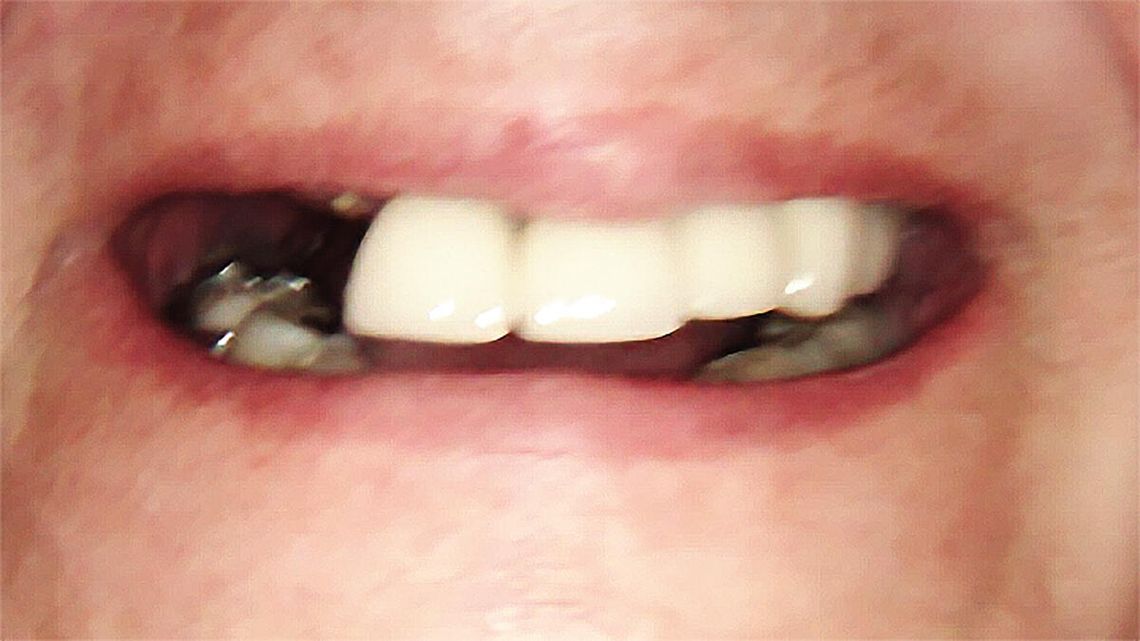 Gdy świąteczna radość spotyka niezręczny moment: prawda o nieświeżym oddechu