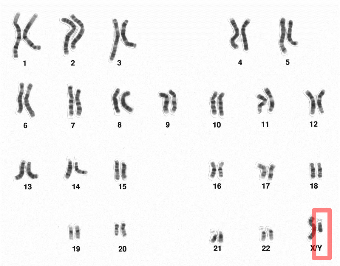 Poznano sekwencję męskiego chromosomu