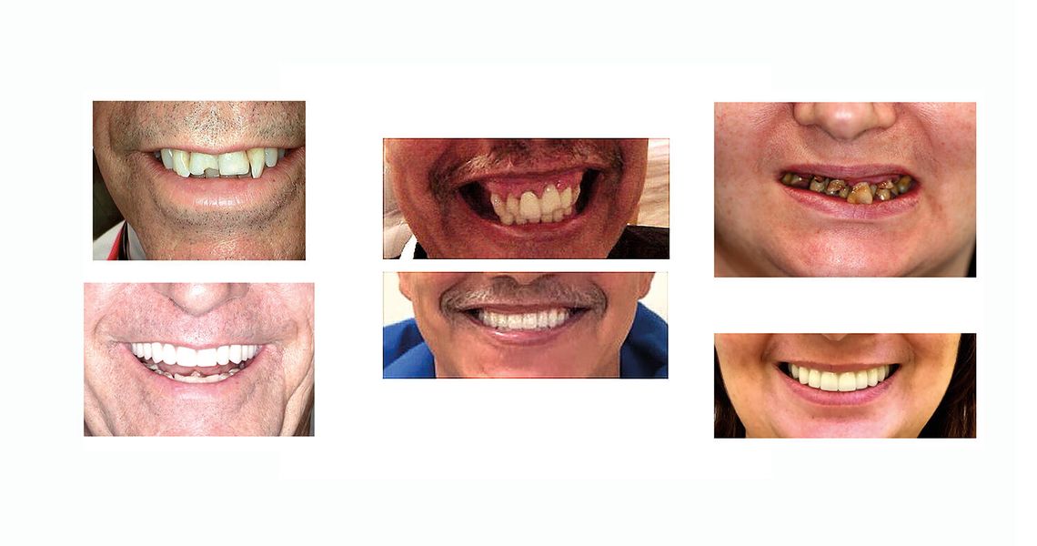 Sedacja w stomatologii: nie musisz już bać się dentysty