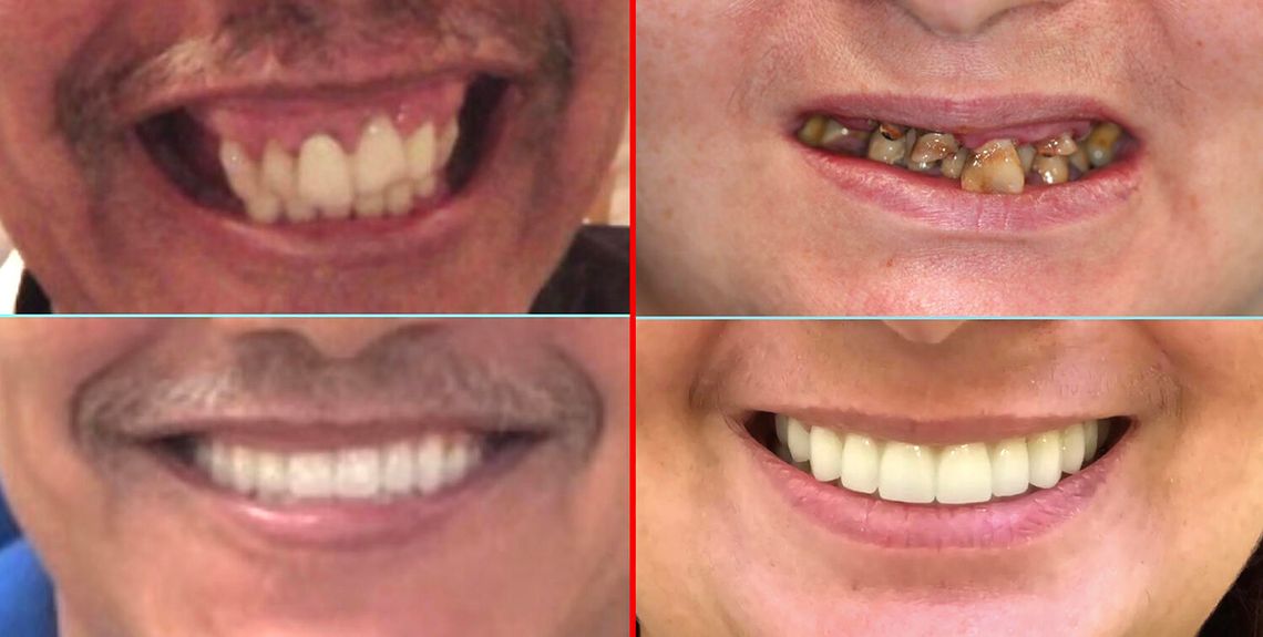 Sezon świąteczny i zdrowie jamy ustnej Sezon świąteczny i zdrowie jamy ustnej