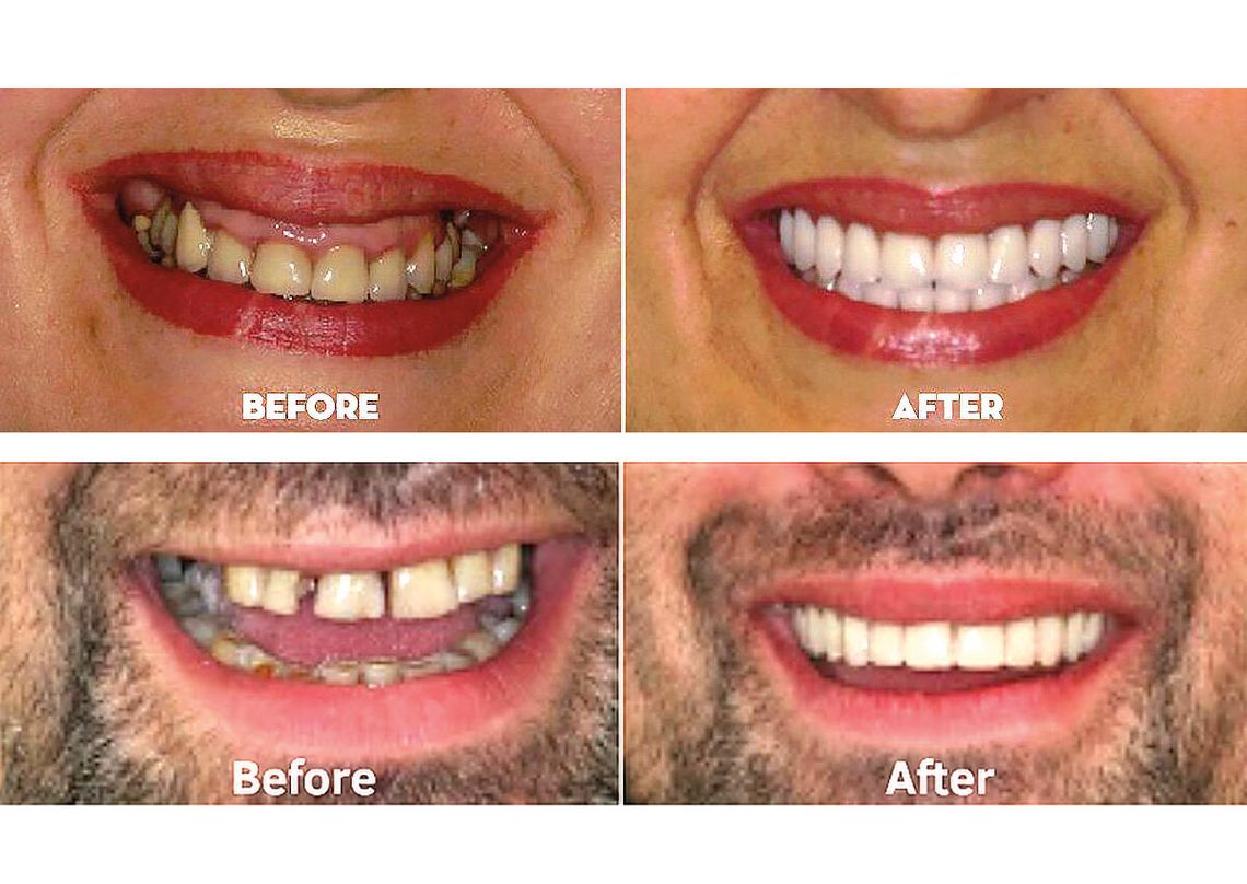 Szukasz lepszej pracy, chcesz zrobić dobre pierwsze wrażenie – zacznij od wizyty u dentysty