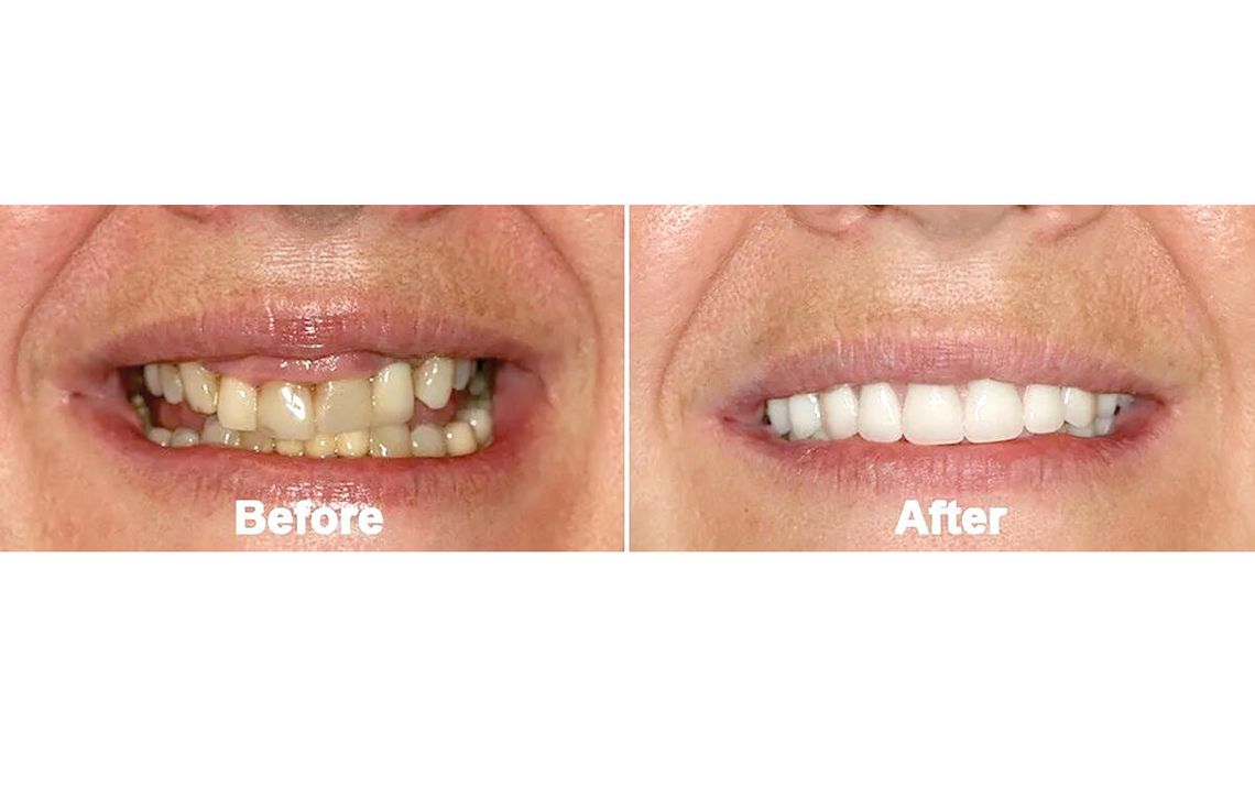 Ukryte infekcje w jamie ustnej i wpływ na zdrowie Ukryte infekcje w jamie ustnej i wpływ na zdrowie