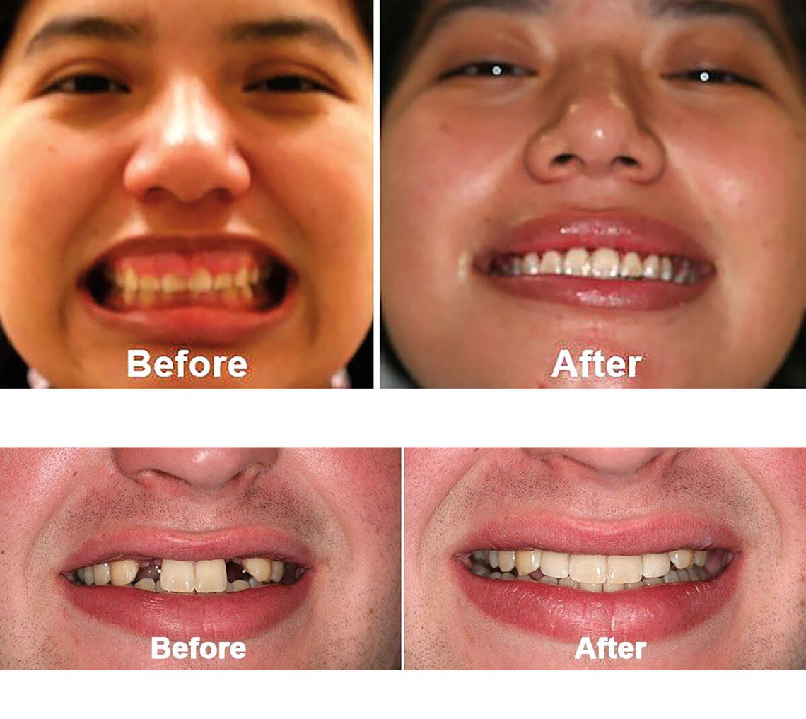 Zasłyszane od pacjentów – czyli obalamy mity dentystyczne